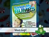 Does Banish My Bumps Really Work