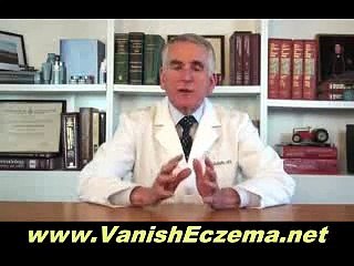 Review of Beat Eczema - How to Cure Eczema Skin Rash Problems