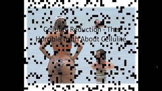 Cellulite Reduction - The Horrible Truth About Cellulite