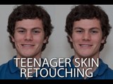 How to retouch the skin of a teenager Photoshop Tutorial - PLP # 52 by Serge Ramelli