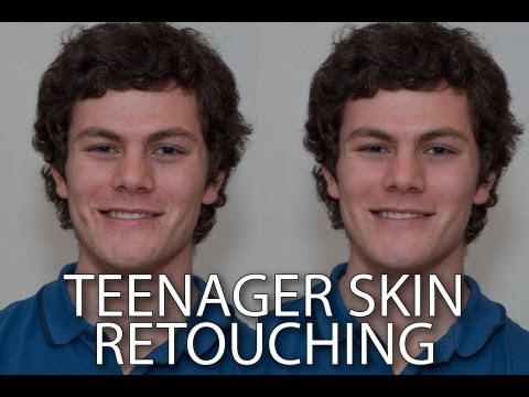 How to retouch the skin of a teenager Photoshop Tutorial - PLP # 52 by Serge Ramelli
