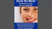 Acne Home Remedies Treatment System acne no more reviews