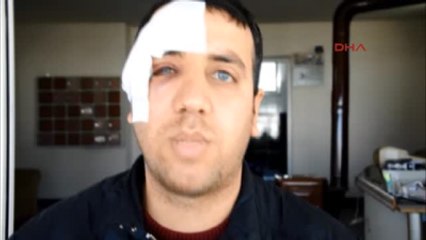 Bira Şişesiyle Yüzüne Vurulan Nazillispor Taraftarı Kör Olabilirdim