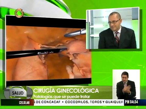 La Laparoscopia es una cirugía 100% segura