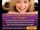 Infecciones Por Hongos No Mas Secreto