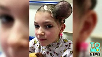 điều trị ung thư đầu cổ