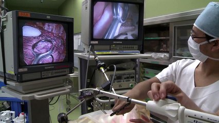 Órgãos humanos feitos em impressoras 3D