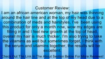 NuHair Thinning Hair Serum, for Men & Women, 3.1-Ounce Bottle Review