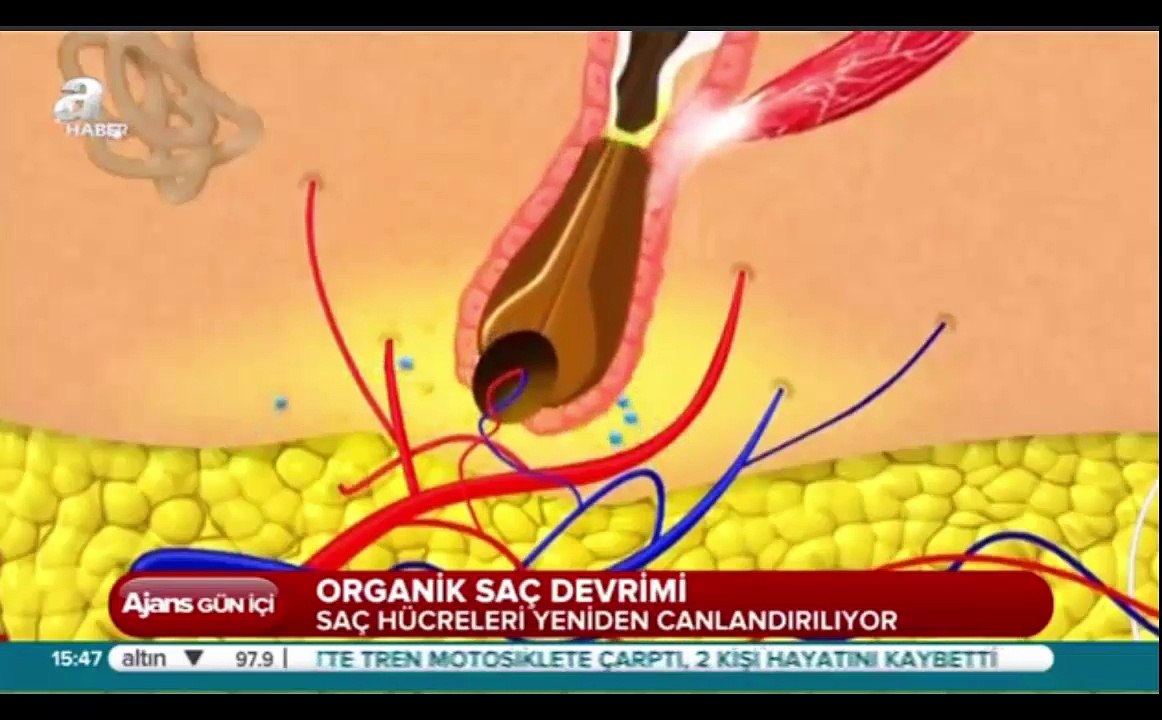 A Haber Organik Saç Ekimi