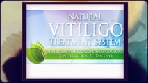 White Patches On Skin - Natural Vitiligo Treatment system