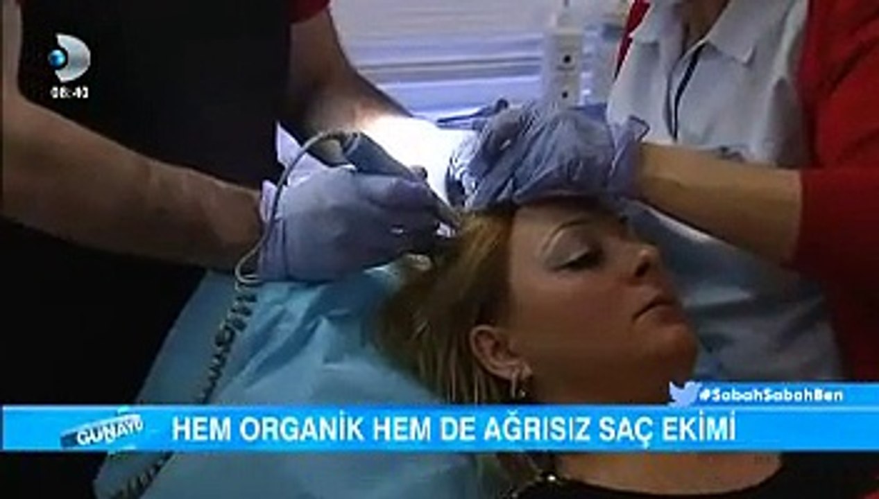 İrfan Değirmenci Kanal D Organik Saç Ekimi