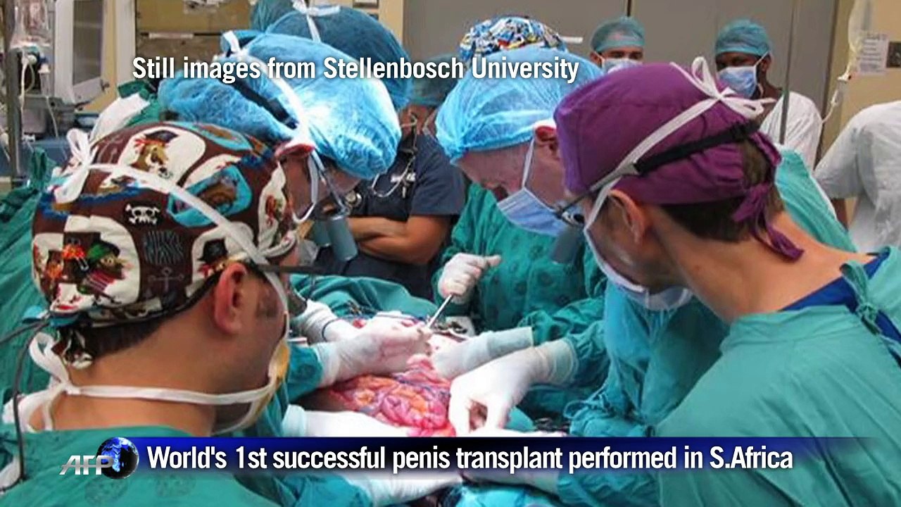 World's first successful penis transplant perfo...