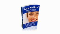 Acne No More Review - Must Watch Before You Buy Acne No More