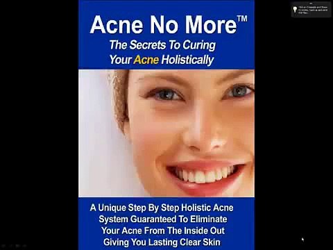 Acne No More System Review - Acne No More By Mike Walden Video.mp4