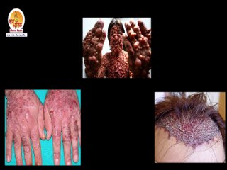 Mysterious..The Giant Hands Boy - Vichitra Khabrein