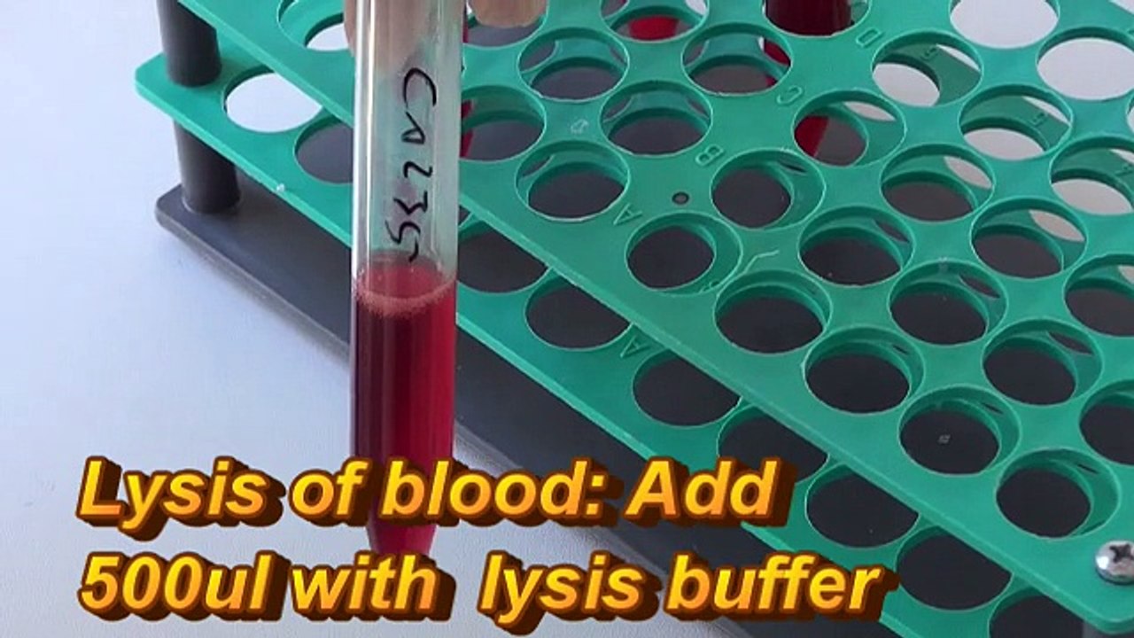 Genekam-magnetic-RNA-isolation from blood for cancer, influenza (H5N1, swine flu), hcv genotyping, HIV, PCR kit detection
