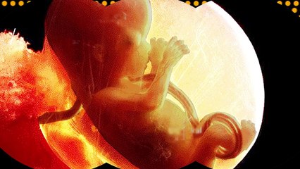 İntihar edən hüceyrələr