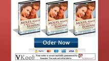 Moles Warts Skin Tags Removal Review-How Get Rid Of Skin Tags