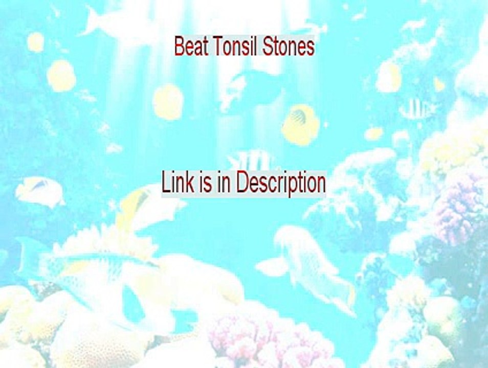 Beat Tonsil Stones PDF (Get It Now)