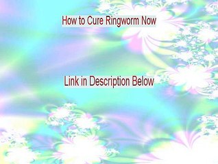 How to Cure Ringworm Now Review (See my Review)