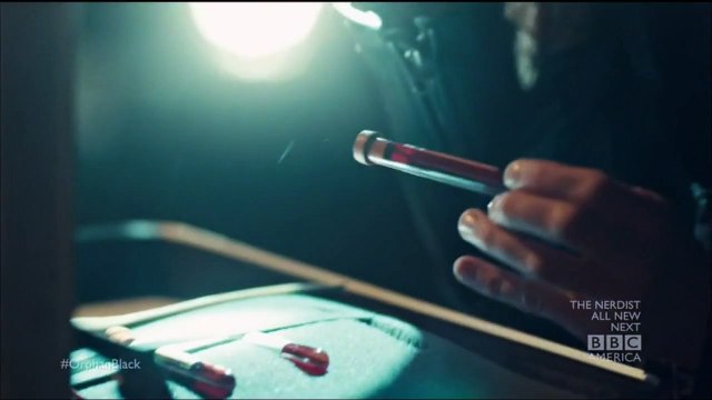 Tatiana Maslany se lastima los nudillos en Orphan Black