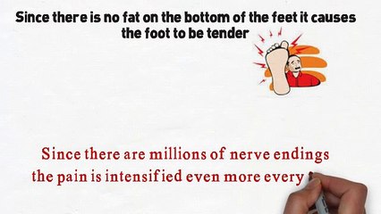 Best Treatment For Plantar Fasciitis