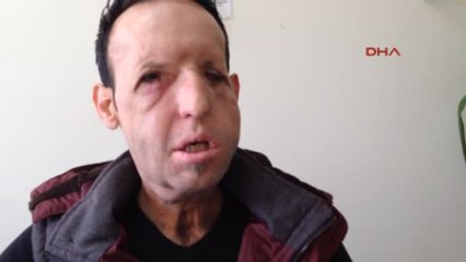 Antalya Recep Sert Sıkıntı Yok Her Şey Yolunda