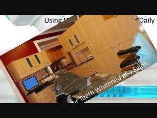 10 Teeth Whitening Mistakes to Avoid By Berkeley Lake Dental.