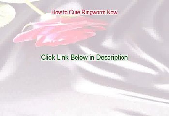 How to Cure Ringworm Now Reviewed - Watch my Review