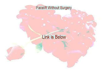 Facelift Without Surgery Reviewed (My Review 2015)