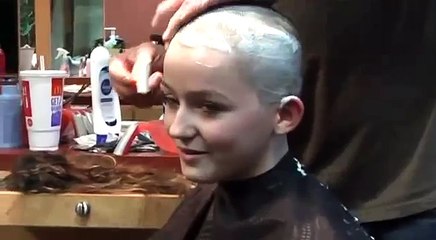 Young Girl Goes Bald