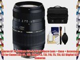 Tamron AF 70-300mm F/4-5.6 Di LD Macro Lens   Case   Accessory Kit for Canon EOS 6D 70D Rebel