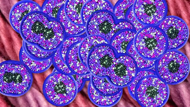 dieu tri ung thu nao , dieu tri ung thu thuc quan