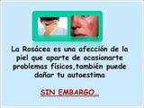 Remedios Caseros Para Curar La Rosacea - Prevenir La Rosacea