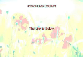 Urticaria Hives Treatment Free Review [My Review 2015]