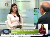 Conozca cuál es el tratamiento para la enfermedad de Cushing