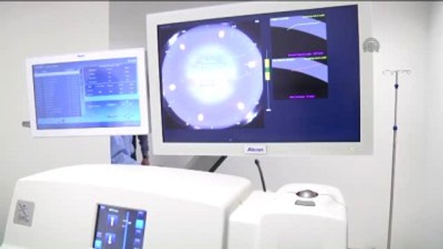 Katarakta Femtosaniye Lazer Teknolojisi ile Müdahale