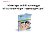 Advantages and disadvantages of Natural Vitiligo Treatment System - Adola.net