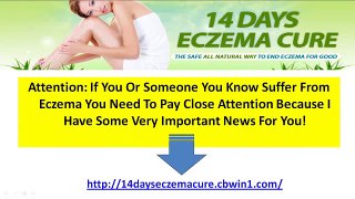 14 Days Eczema Cure - The Safe And Natural Way To Cure Eczema