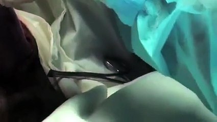 (Video) Vea cómo médicos ticos practican una cesárea a una osa perezosa herida en el pacífico central