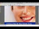 Acne No More Clear Your Skin The Holistic Way! Best Acne Products [Acne No More Book]