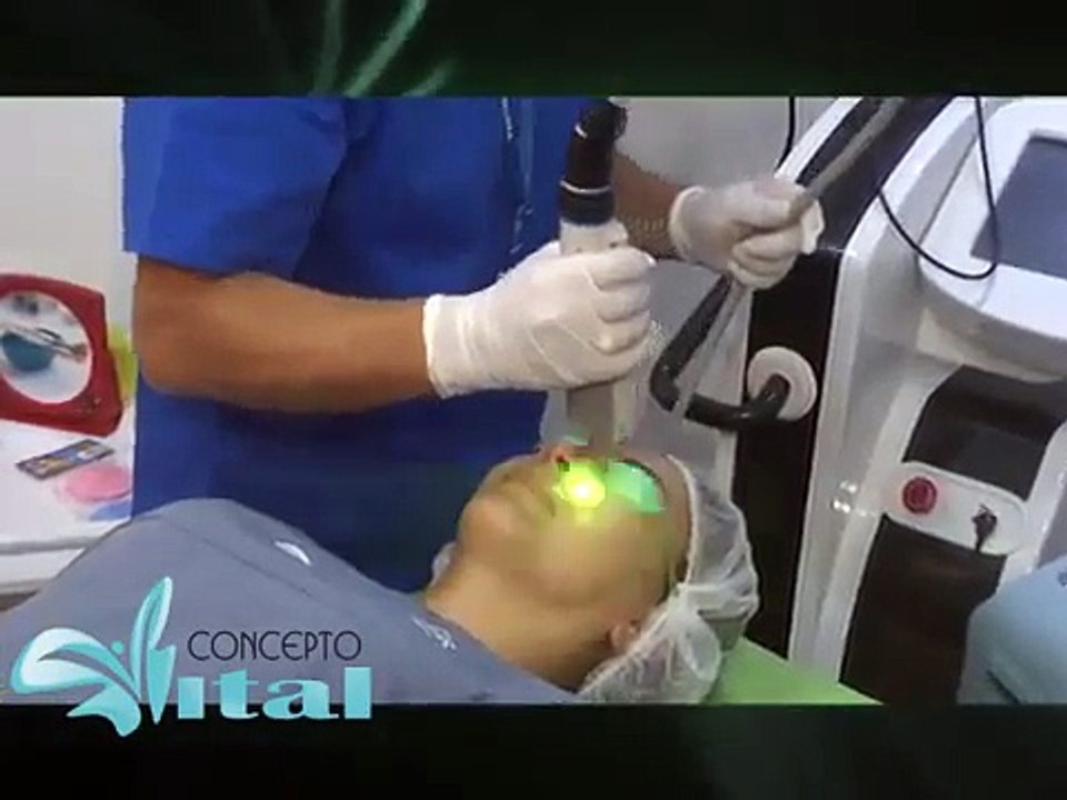 Tratamiento de la Rosacea con el Laser Cutera XEO DR LUIS EDUARDO MARTINEZ   CLINILASER