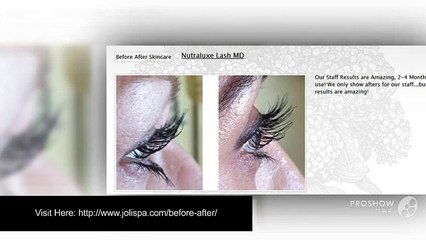 Before And After Skincare Treatments By Joli Visage Clinic