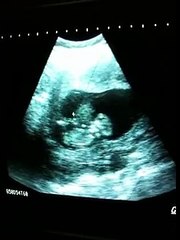 Bébé s'amuse dans le ventre de sa maman