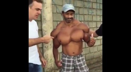 Ce type s'est injecté trop de produits de les muscles, voici le résultat !