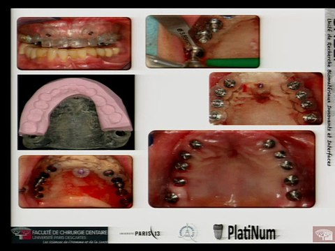 JNUM 2015 - Impact de la 3D sur les soins dentaires