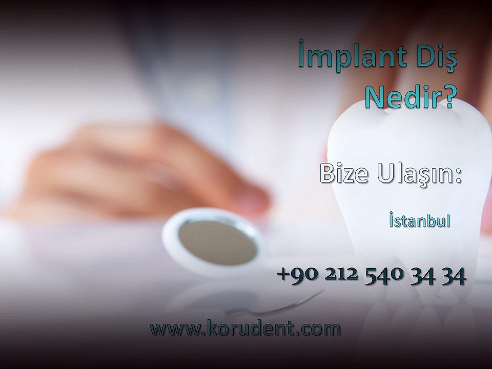 İmplant Diş Nedir? İmplant Diş Nasıl Yapılır? İmplant Diş Fiyatları