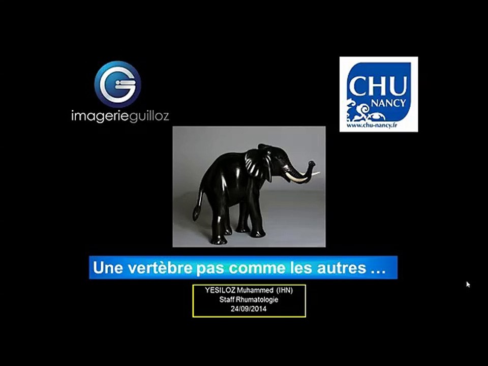Une vertèrbre pas comme les autres