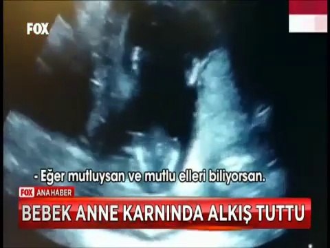 Anne karnındaki bebek ultrasonda anne babasının şarkısına alkışla tempo tuttu