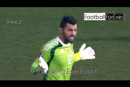 Russia goalkeeper Igor Akinfeev hit by flare